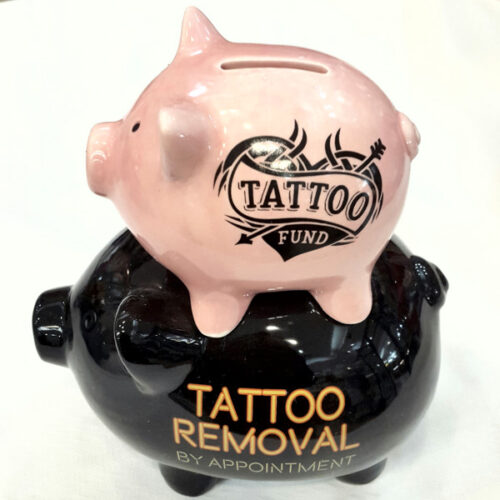 tattoo-fund-tattoo-removal-by-appointment